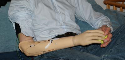 Patient with Prosthesis