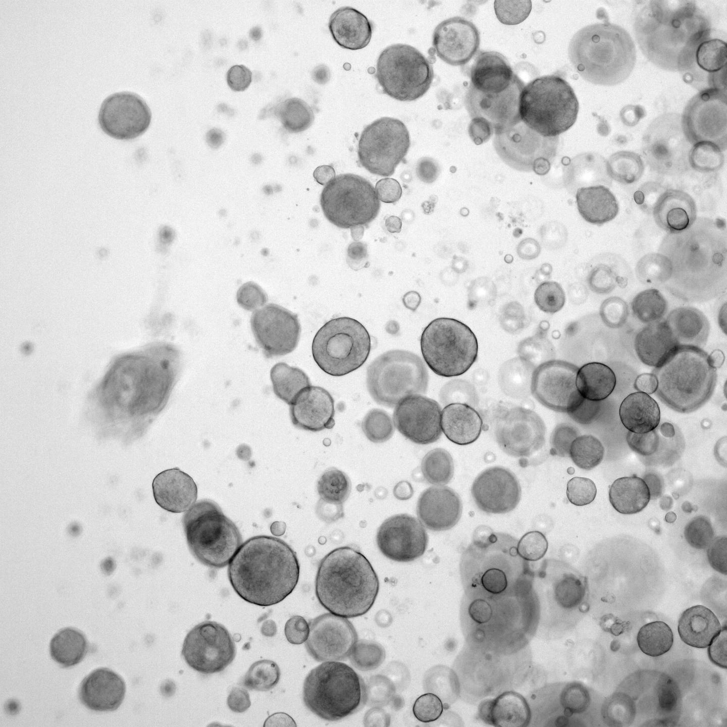 Patient-Derived Organoids Help Predict How Patients Respond to Chemotherapy (3 of 5)