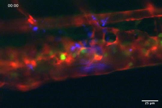 Green Platelets Sticking to Red Blood Vessels Next to Sites of Infection by Blue Bacteria