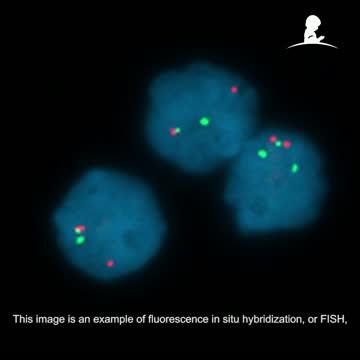 Genetic Basis of a Leukemia Subtype Revealed Along with a Possible Targeted Therapy