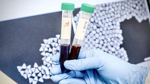 DNA barcodes help NUS researchers pinpoint gold nanoparticles_photo 2