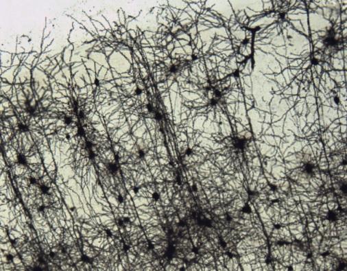 Neurons