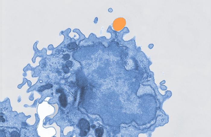 Pseudocolored electron microscope image