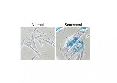 Oncogene-Induced Senescence