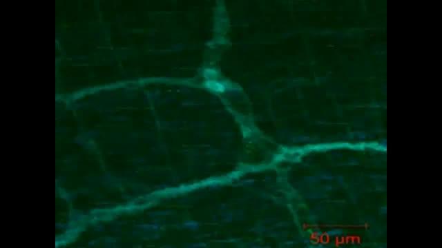 Enteric Video