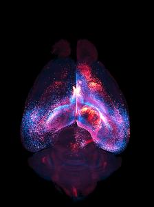 3D network of interconnected astrocytes imaged inside a whole, transparent mouse brain.