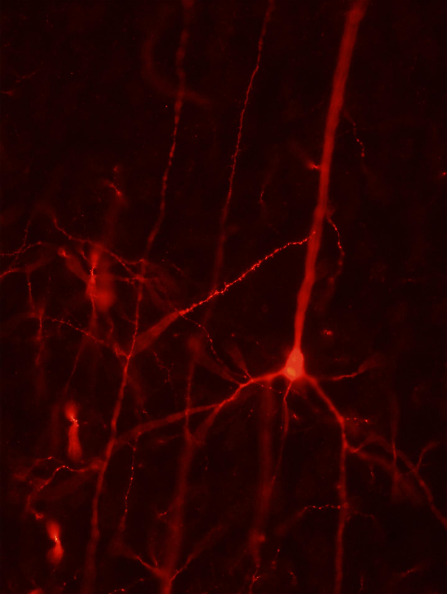 Pyramidal Neuron