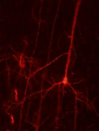 Pyramidal Neuron