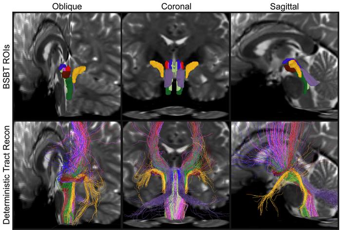 Brainstem bundles