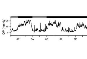 Eye pressure measurements