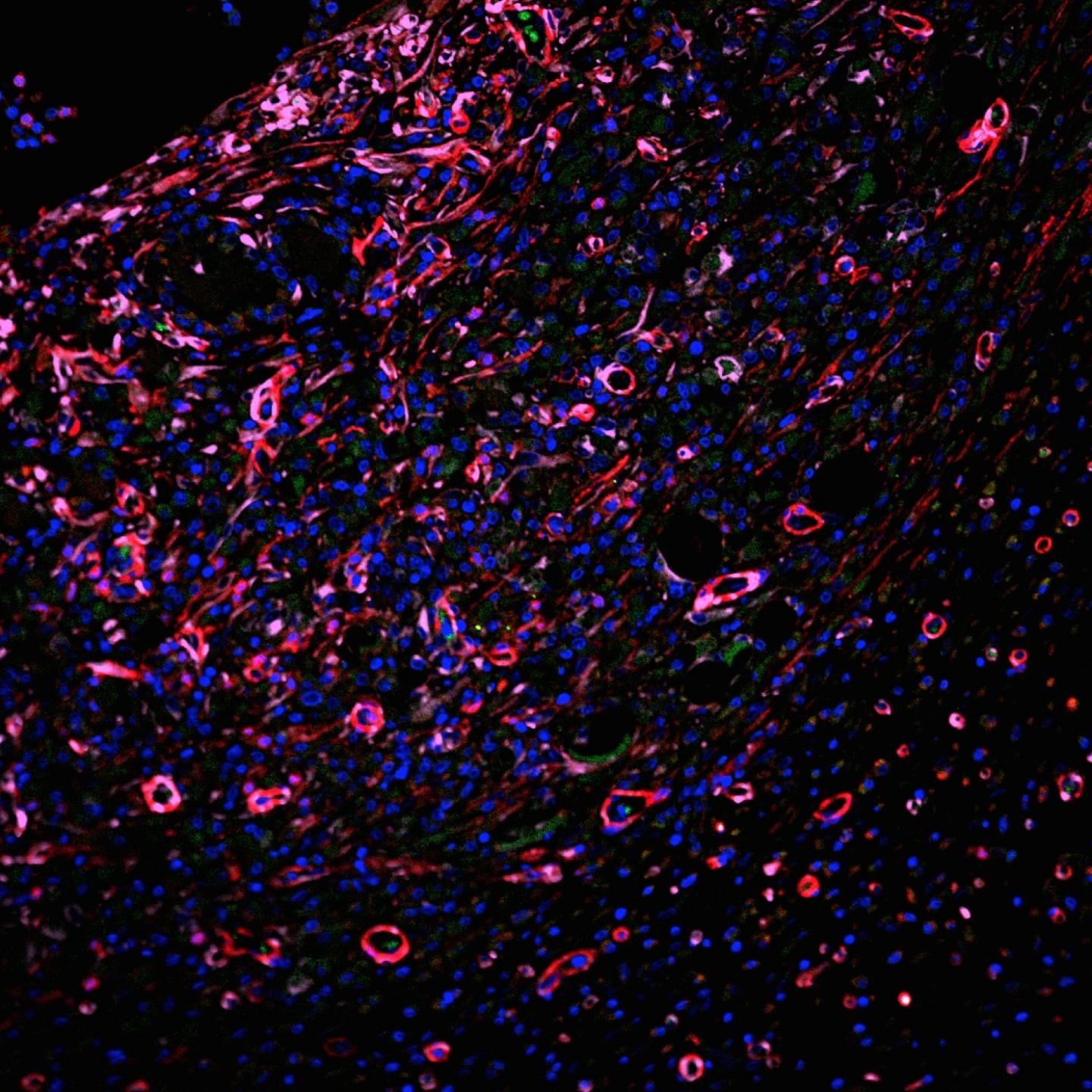 Hydrogel (2 of 2)