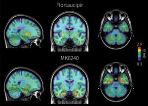PET brain scans comparing tau pathology detected with flortaucipir and MK-6240 in early Alzheimer’s disease