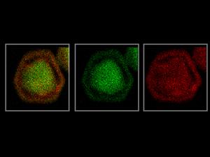 TEM imaging of gold-silver-gold nanoparticle