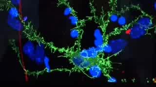 Franck Polleux, Ph.D. Discusses Cell Change
