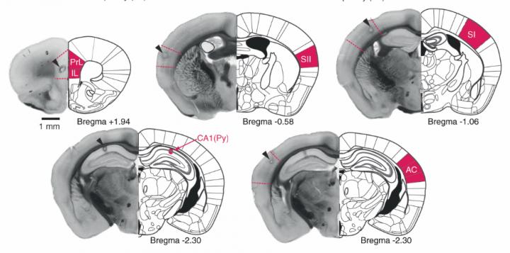 Sleep Varies From Moment to Moment, with Some Moments 'Sounder' Than Others (1 of 3)