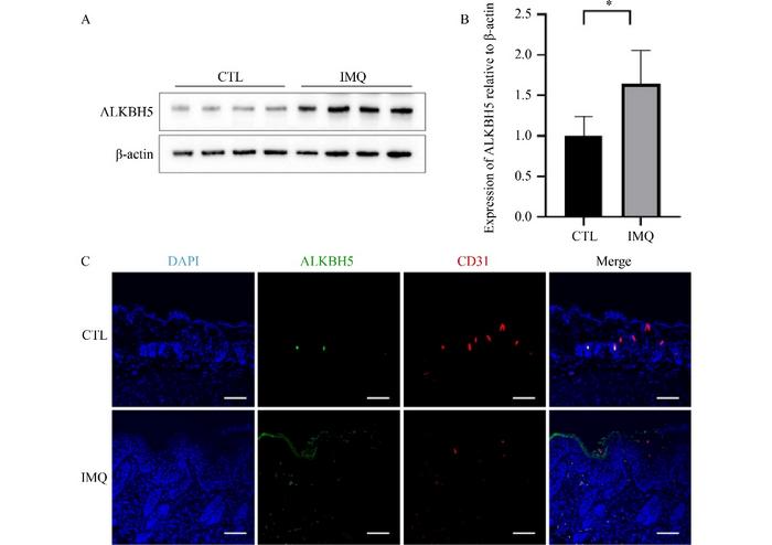 ALKBH5 is highly expressed in the skin of psoriatic mice.