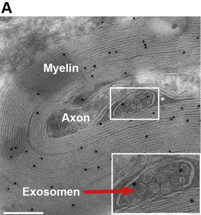 Exosomes (1 of 2)