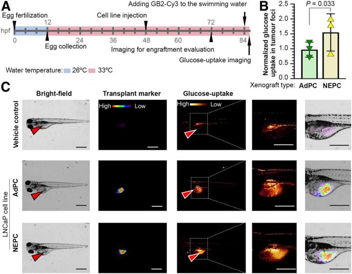Neuroendocrine-induced LNCaP cell line xenografts represent higher glucose uptake in zebrafish model.