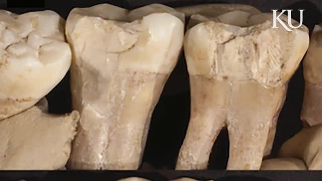 Researchers Find Evidence of Neanderthal Dentistry