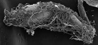 Scanning Electron Microscopy Image of the Honey Bee Midgut
