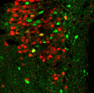 Brain Tissue