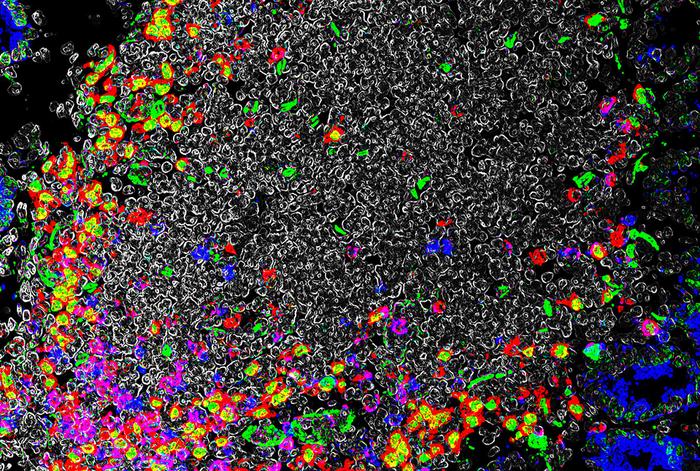 Image visualizing immune cell aggregates in the intestine, demonstrating the presence of RORγt+ APCs (red and green) and T cells (blue and red), whose interactions are critical in establishing immune tolerance in the intestine.