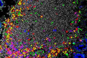Image visualizing immune cell aggregates in the intestine, demonstrating the presence of RORγt+ APCs (red and green) and T cells (blue and red), whose interactions are critical in establishing immune tolerance in the intestine.