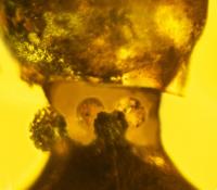 Neck Glands