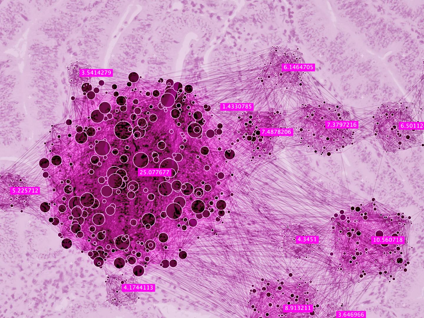 Endometrial Cancer