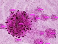 Endometrial Cancer