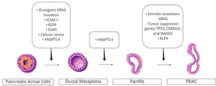 Pancreatic cancer pathways