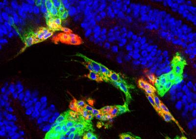 Microscopy