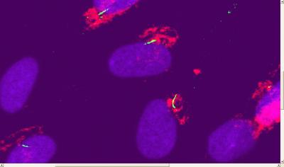 Cilium