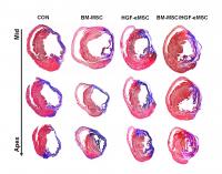 Comparison of Cardiac Tissues of Hearts Treated with Primed and Unprimed Cells