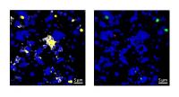 New Organic Carbon Mostly Accumulates on Existing Hot Spots