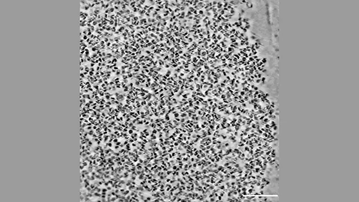 Imaging chromatin condensates