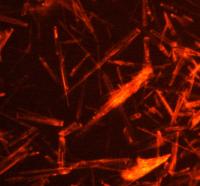 Uric Acid Crystals (2 of 2)