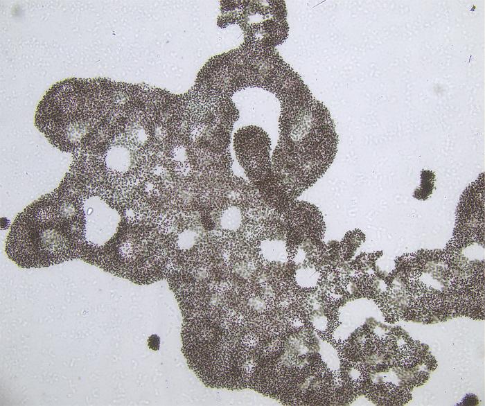 Cyanobacteria under the microscope