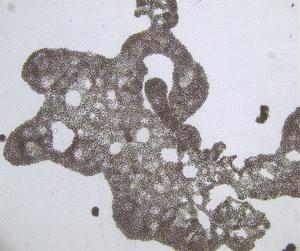 Cyanobacteria under the microscope