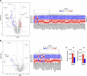 Hypoxia induced lipid droplet accumulation promotes resistance to ferroptosis in prostate cancer