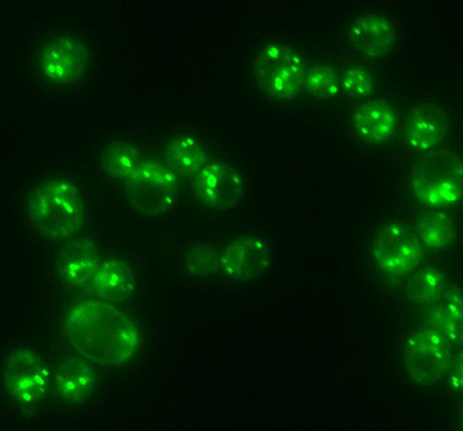 Lipids in Yeast Cells