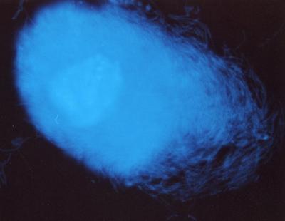 How Beetles Keep Bacteria in Check (3 of 15)