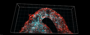 Microscopic image of the 3D-bioprinted glioblastoma model.