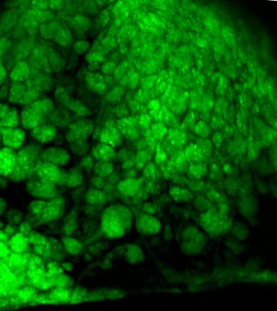 Olfactory Glomeruli