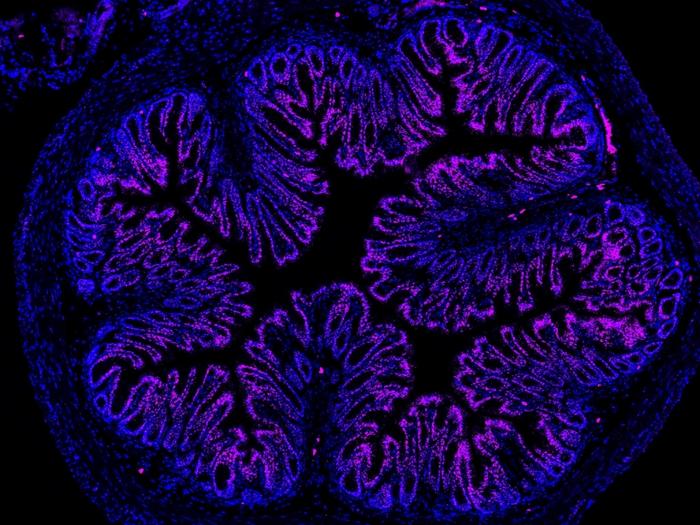 Nanoparticles to treat gut pain