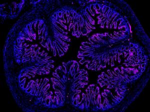Nanoparticles to treat gut pain