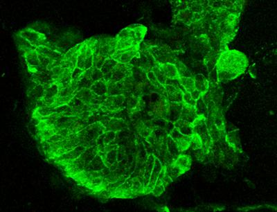 3-Dimensional Hydrogel for Brain Research