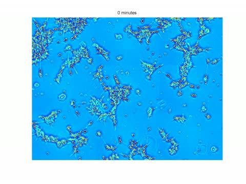 Untreated Neuron Network Growth over 24 Hours