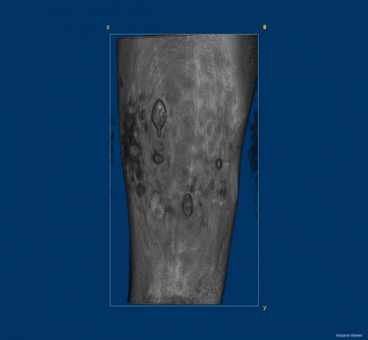 MRI Scan Showing Alternative Markers Trialed