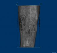 MRI Scan Showing Alternative Markers Trialed
